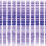 Analisis Pita (Band) DNA Menggunakan Gel-Pro Analyzer